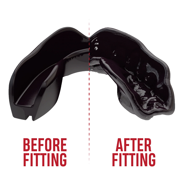 SafeJawz Mouth Guards Safejawz Intro Range Mouthguard Black