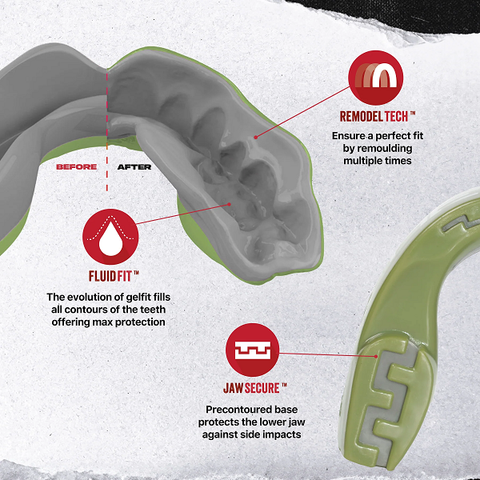 SafeJawz Mouth Guards Safejawz Extro Series REORG Mouthguard Green