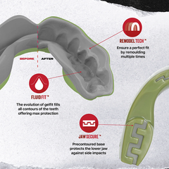 SafeJawz Mouth Guards Safejawz Extro Series REORG Mouthguard Green