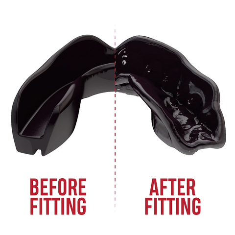 SafeJawz Mouth Guards Safejawz Intro Range Mouthguard Black