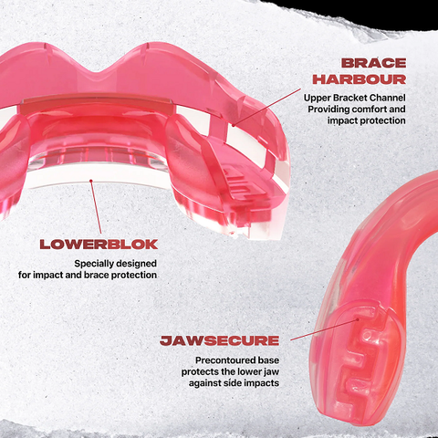SafeJawz Mouth Guards Safejawz Mouthguard for Braces Pink